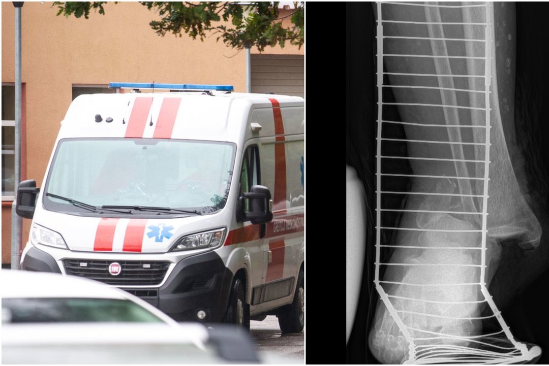 Medikai siunčia perspėjimą lietuviams (tv3.lt fotomontažas)